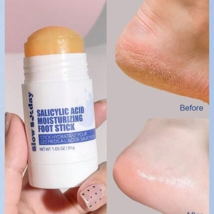 Premium Salicylic Acid Foot Balm Stick for Dry Skin Repair
